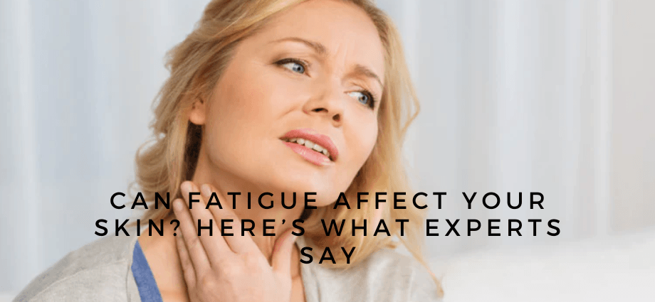 Can Fatigue Affect Your Skin Here’s What Experts Say image
