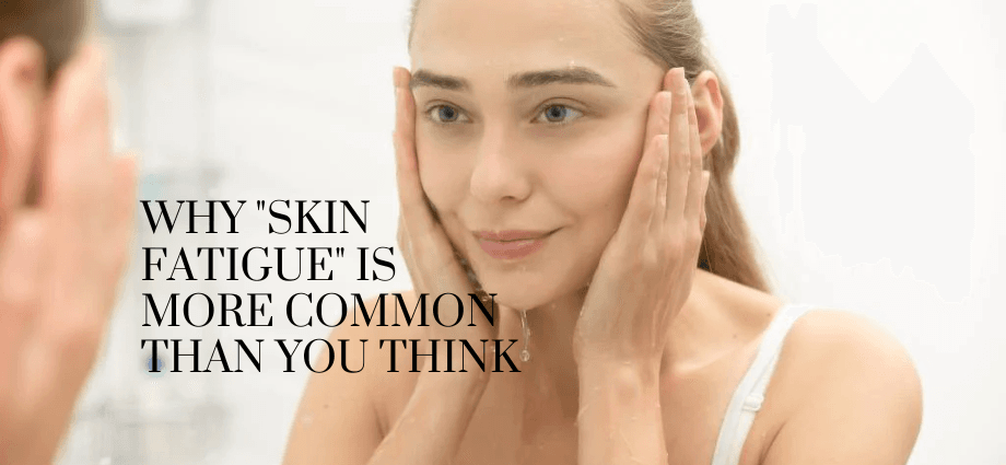 Why Skin Fatigue Is More Common Than You Think image